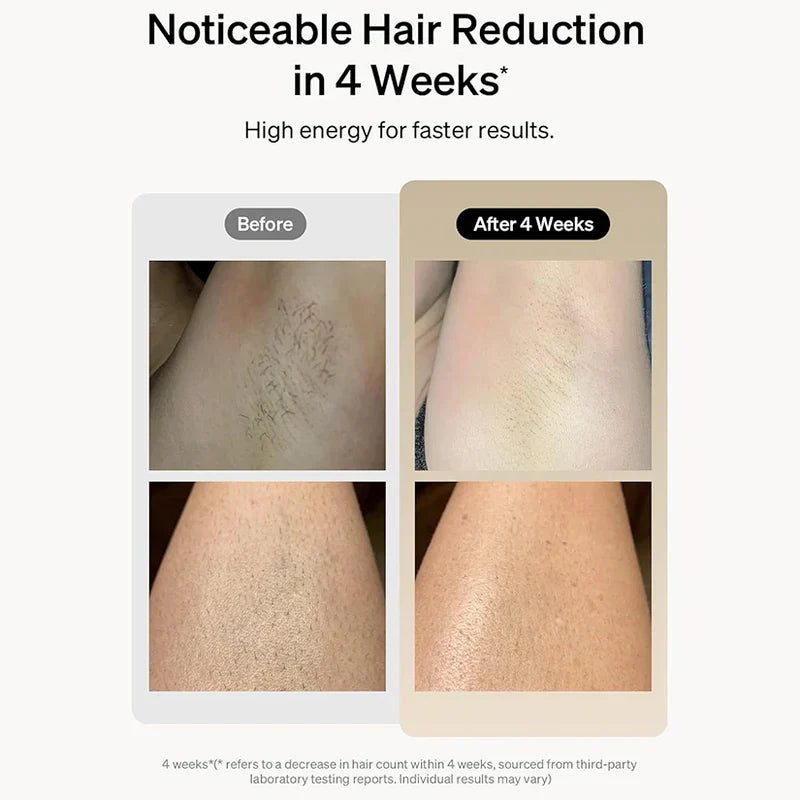 IPL Hair Removal Device for Women & Men